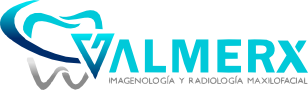 ALMERX