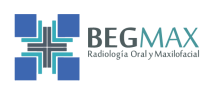 BEGMAX